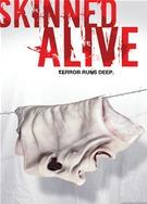 Skinned Alive